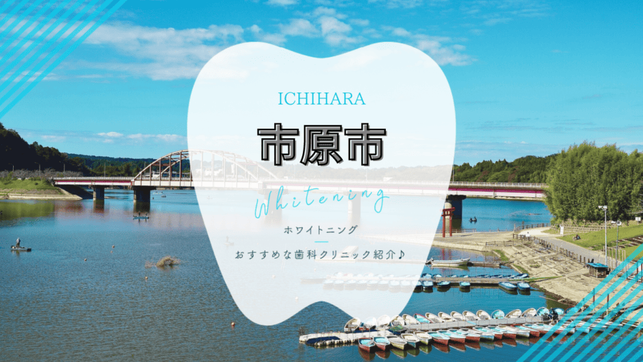 市原市でホワイトニング