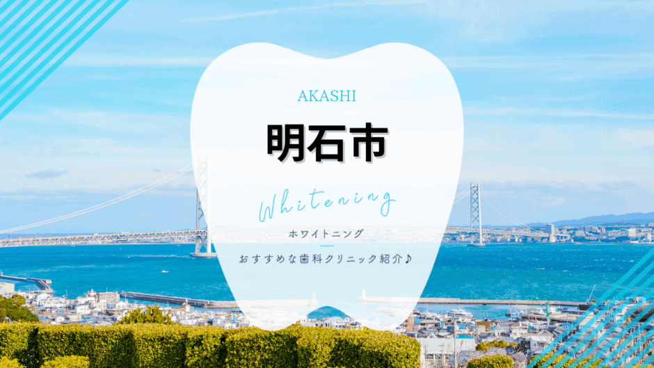 明石市でホワイトニング