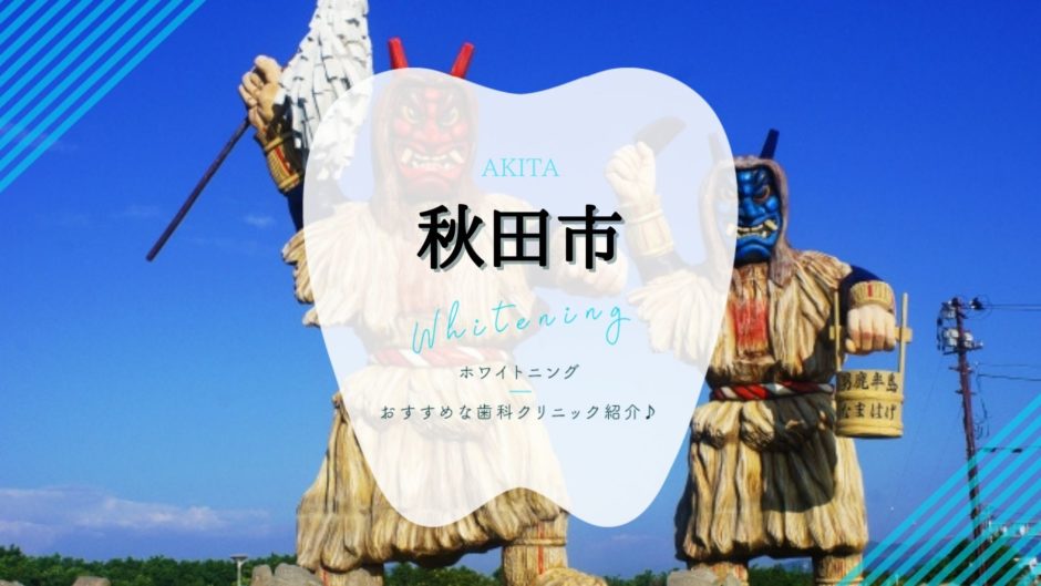 秋田でホワイトニング