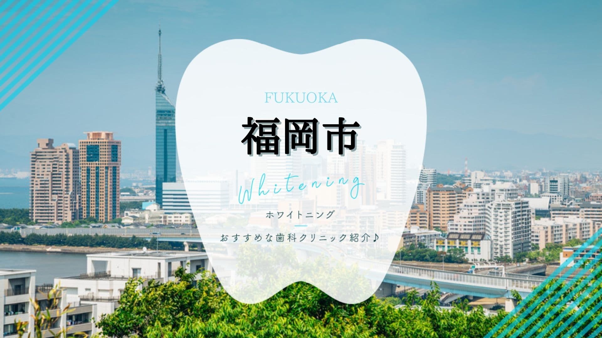福岡市 ホワイトニングにおすすめな歯科9選 2021年版