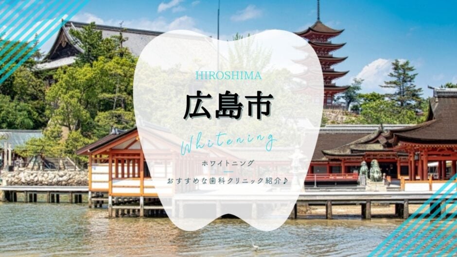 広島でホワイトニング