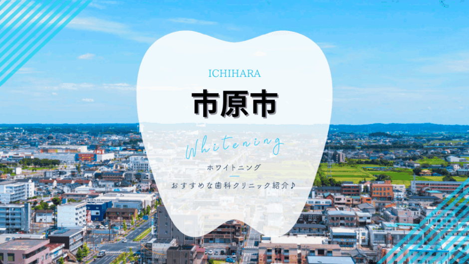 市原市でホワイトニング