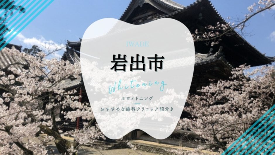 岩出でホワイトニング