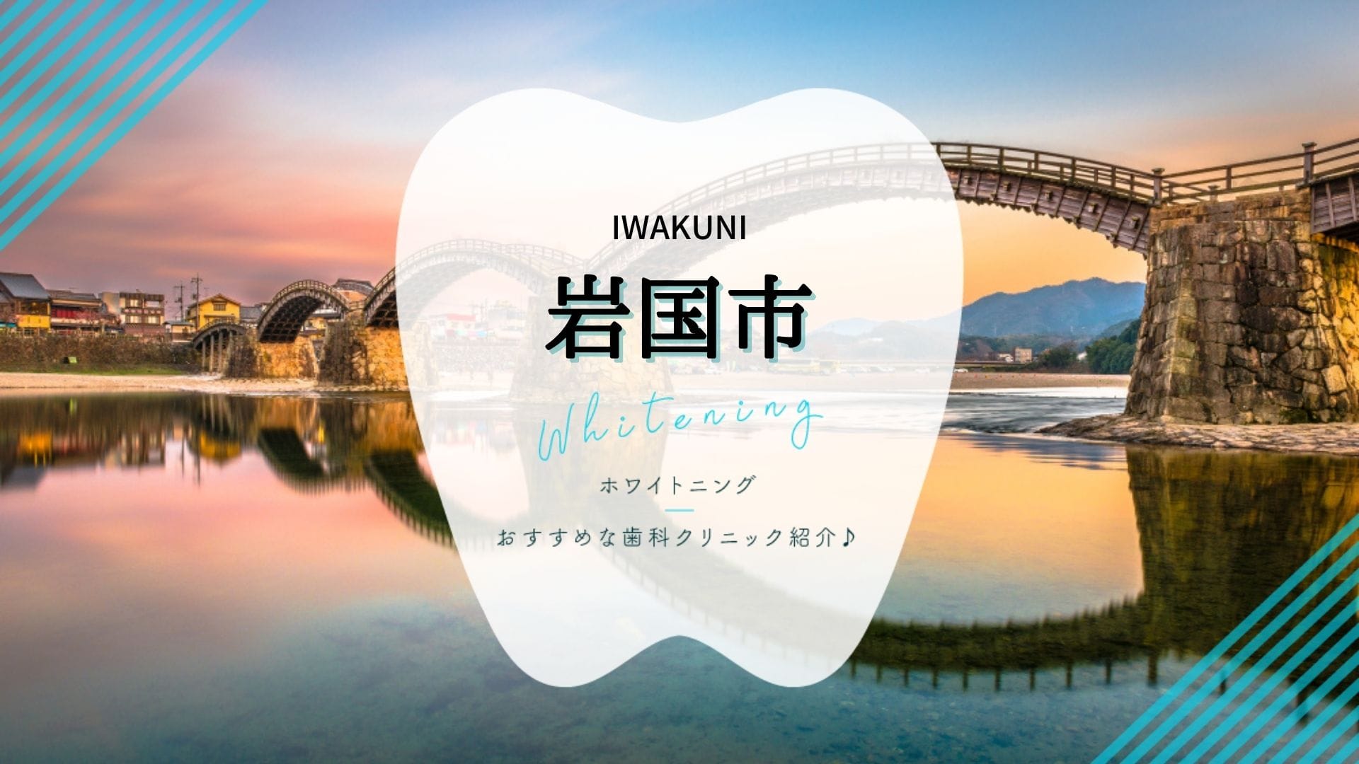 岩国市 歯のホワイトニングにおすすめ歯科クリニック5選