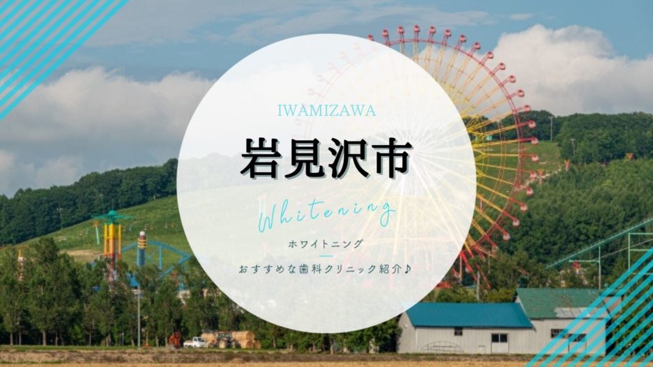 岩見沢でホワイトニング