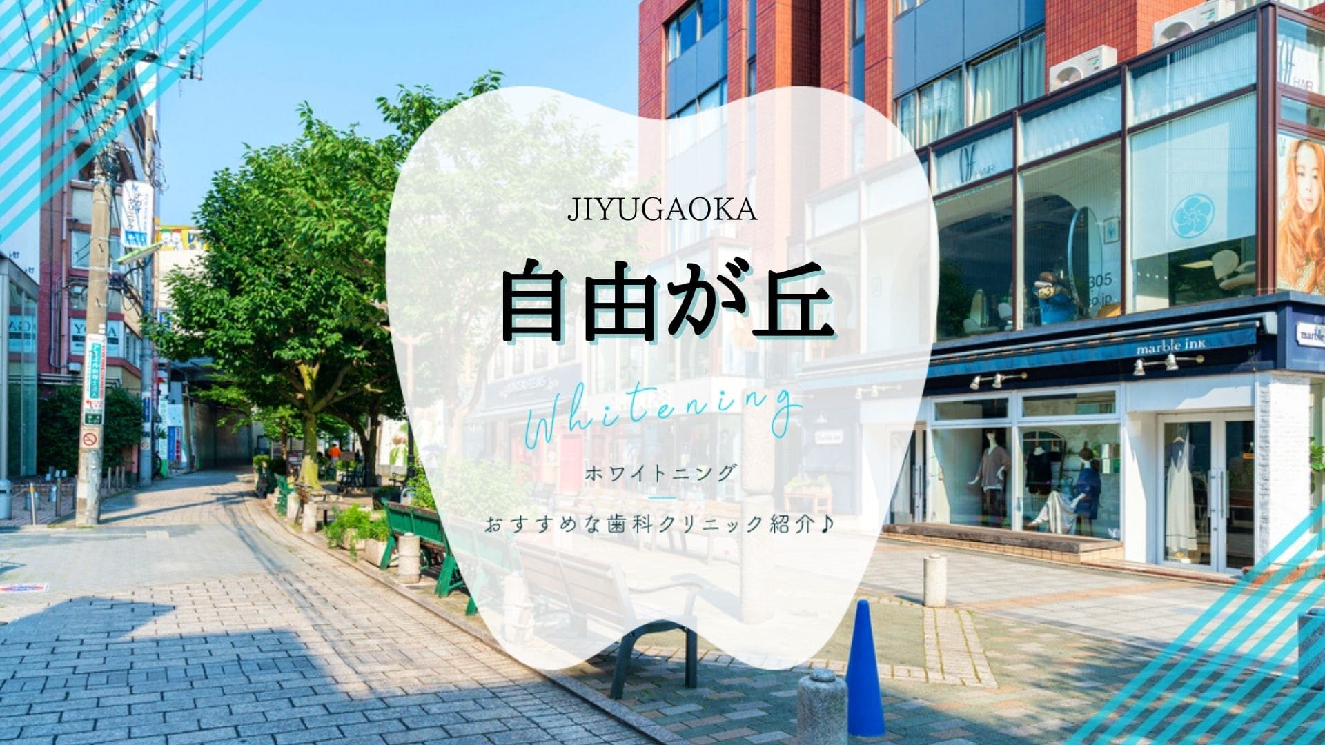 22年版 自由が丘でホワイトニング安い歯科5選を解説