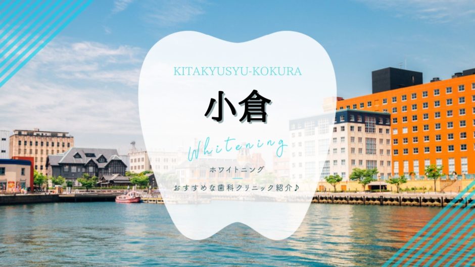 小倉駅でホワイトニング