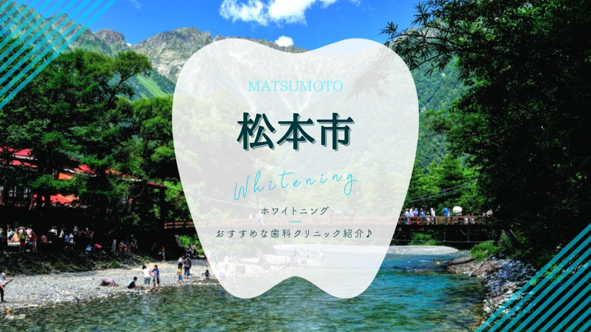 松本市 ホワイトニングが安いおすすめ歯科5選 22年版