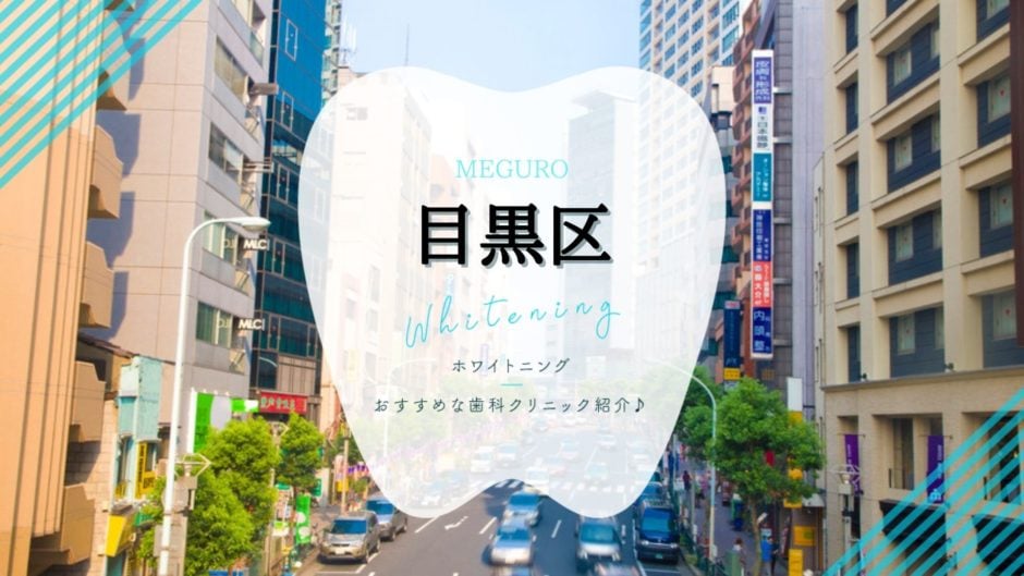 目黒区でホワイトニング
