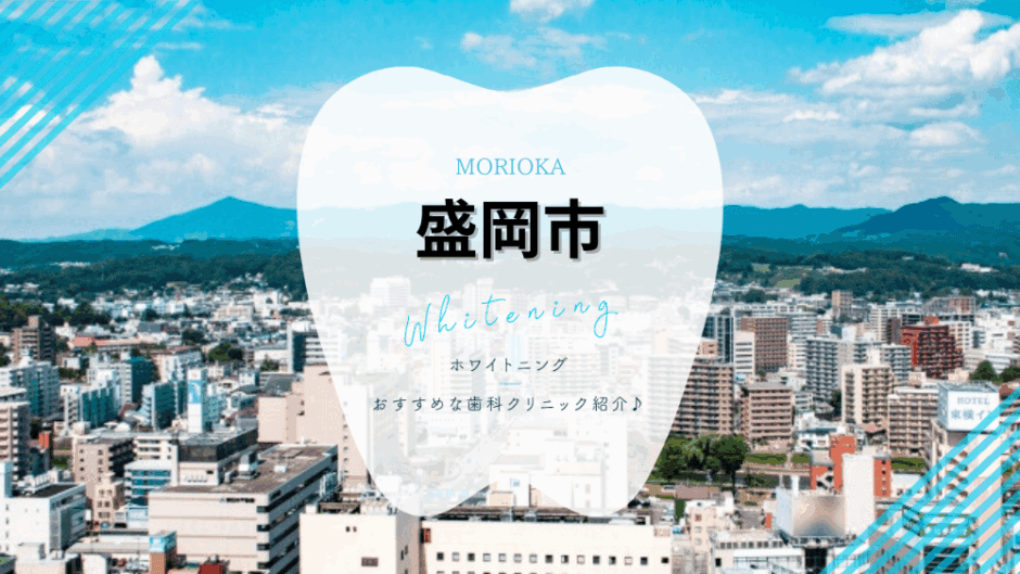 盛岡でホワイトニング