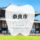 奈良市でホワイトニング