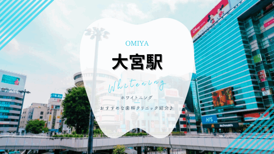 大宮駅でホワイトニング
