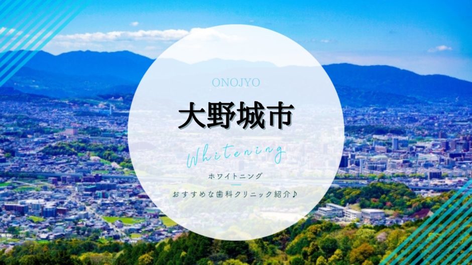 大野城でホワイトニング