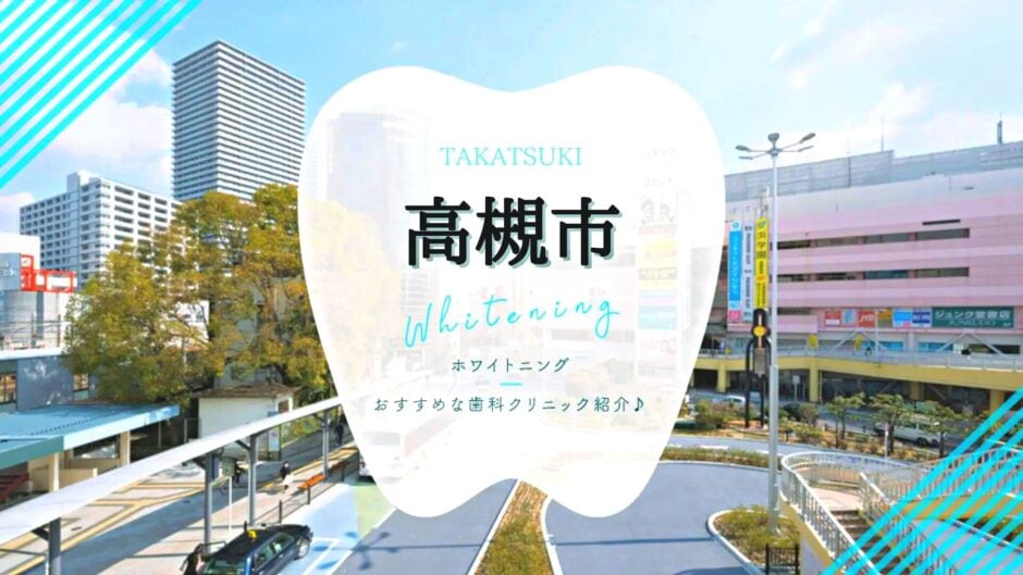 高槻でホワイトニング
