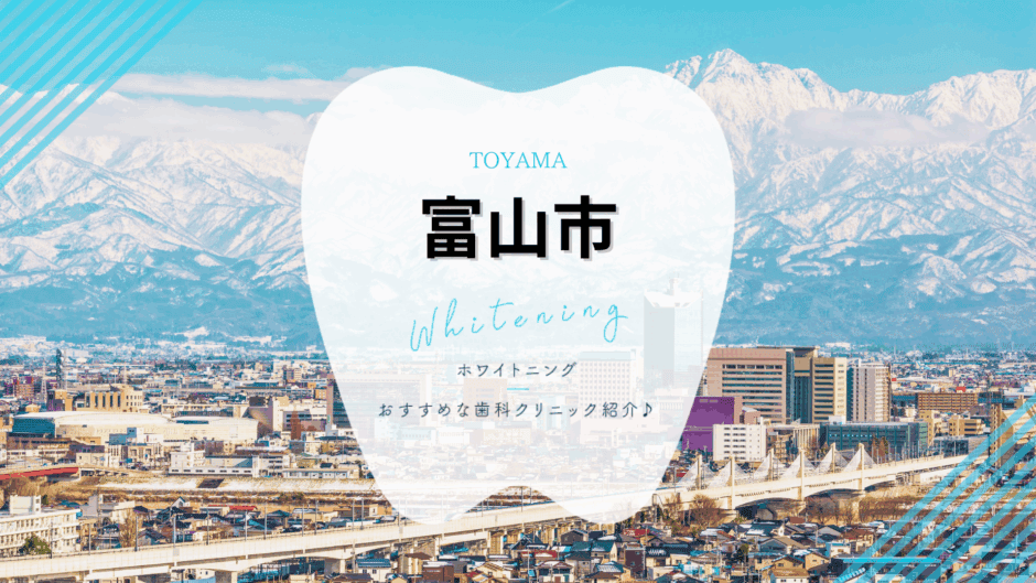 富山市でホワイトニング