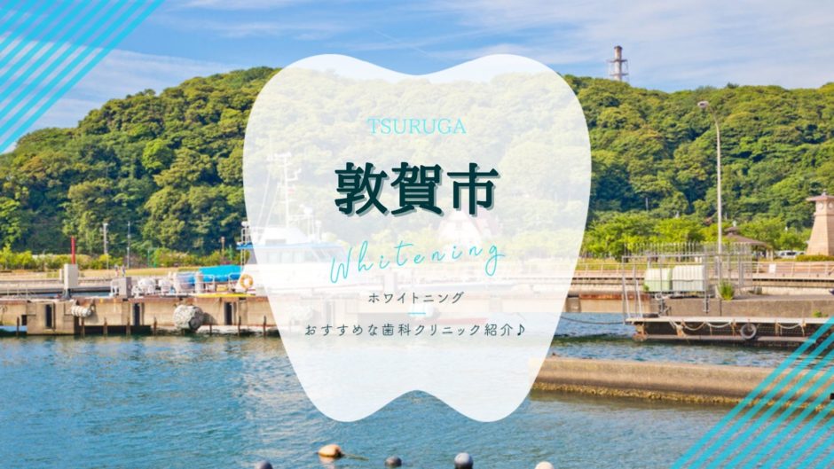 敦賀でホワイトニング