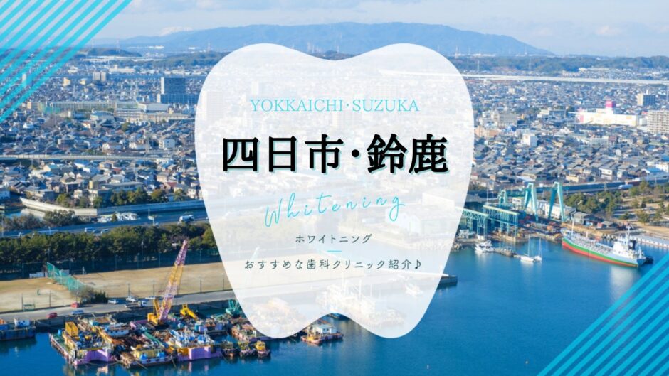 四日市/鈴鹿でホワイトニング