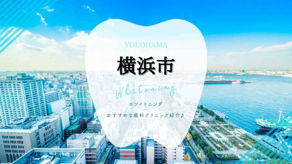 横浜でホワイトニング