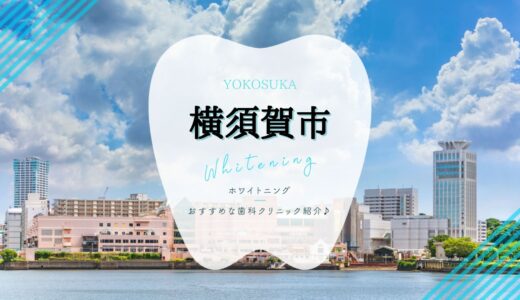 【横須賀市】ホワイトニングにおすすめな歯科7選！【2022年版】