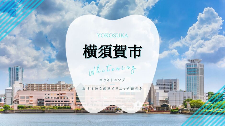 横須賀でホワイトニング