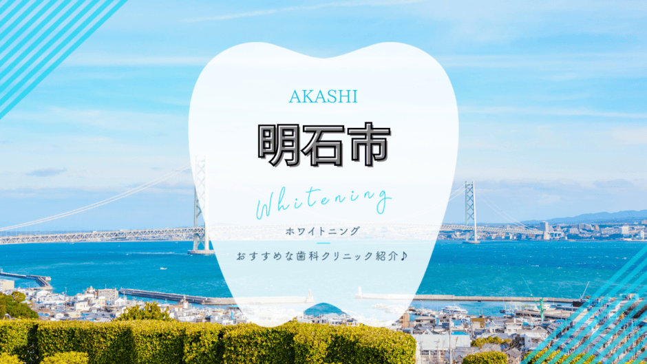 明石市でホワイトニング