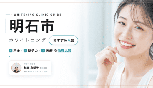 明石市でホワイトニングおすすめ4選｜料金・口コミを徹底比較【2026年最新】