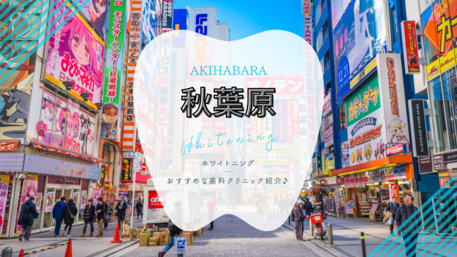 秋葉原でホワイトニング