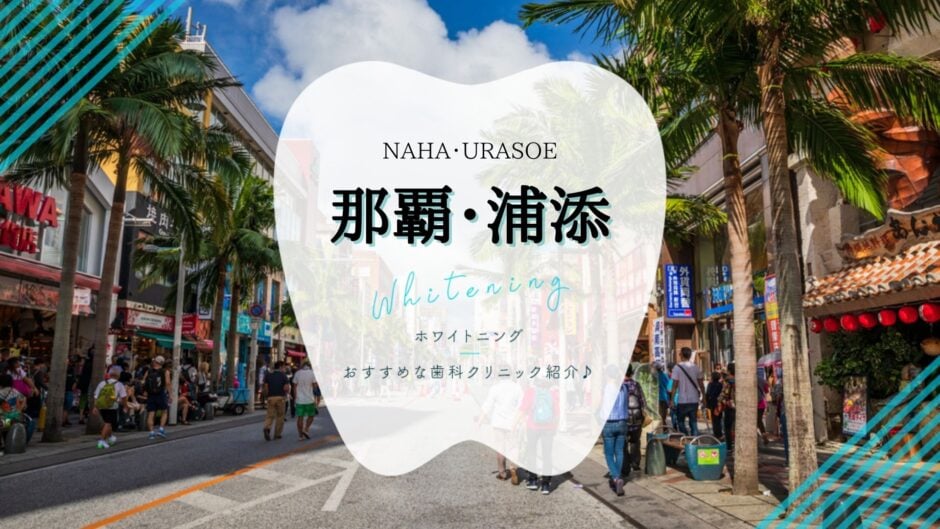 那覇市・浦添市でホワイトニング
