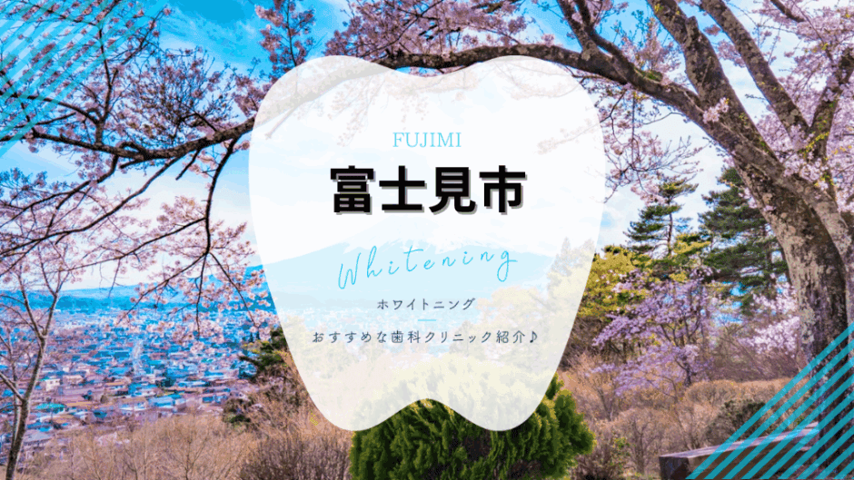 富士見市でホワイトニング