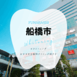 船橋市でホワイトニング