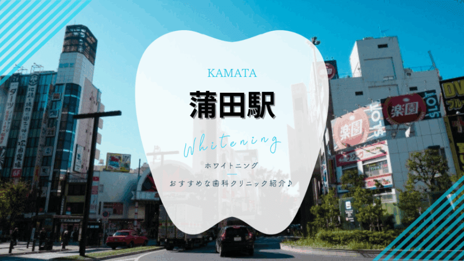 蒲田でホワイトニング