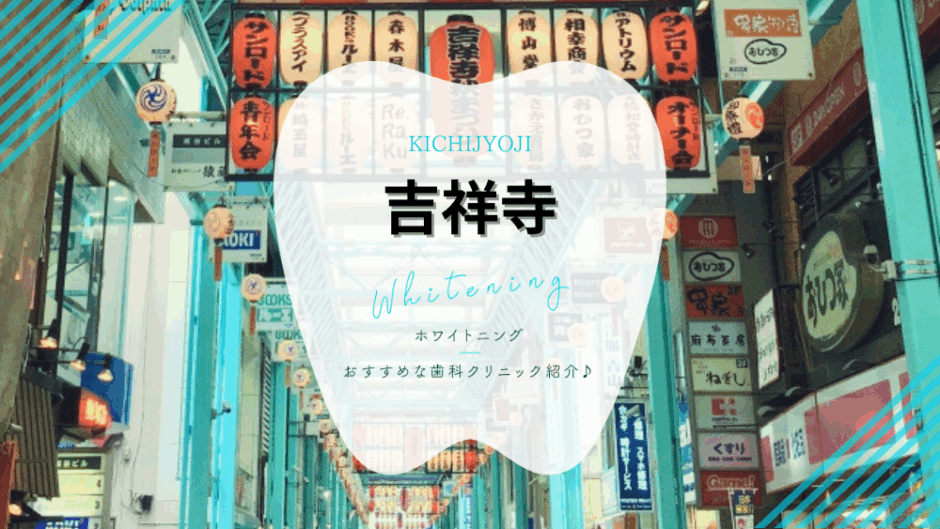 吉祥寺でホワイトニング