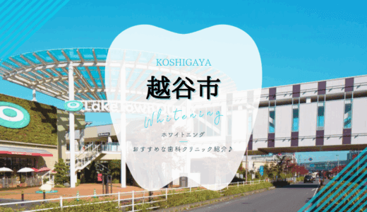 【2025年最新】越谷市でおすすめホワイトニング7選｜料金・口コミを徹底比較
