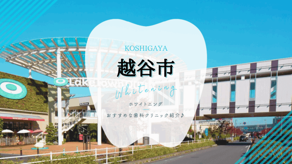 越谷でホワイトニング