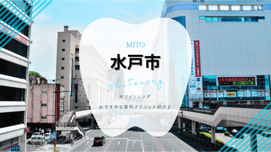 水戸でホワイトニング
