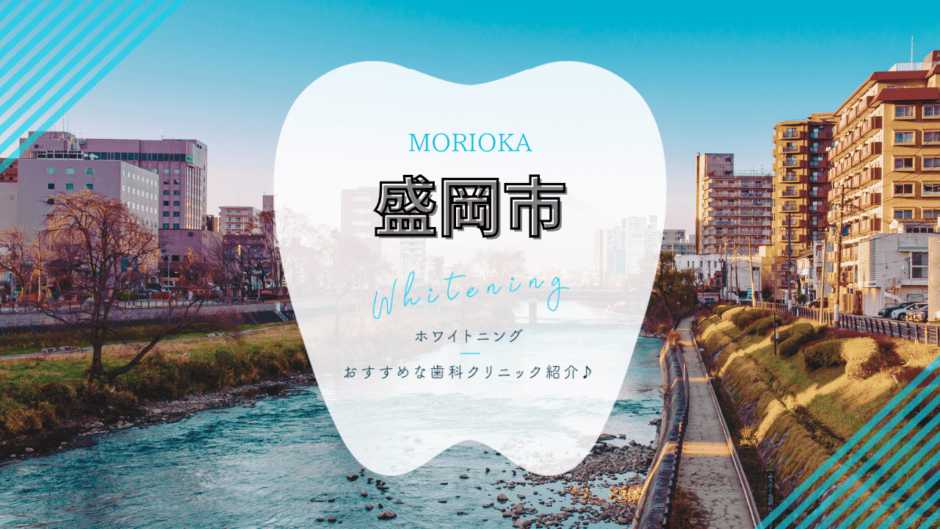 盛岡でホワイトニング