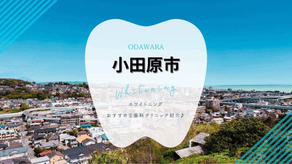 小田原でホワイトニング