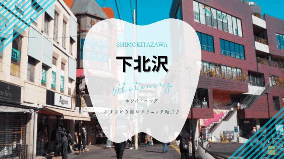 下北沢でホワイトニング