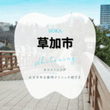 草加でホワイトニング