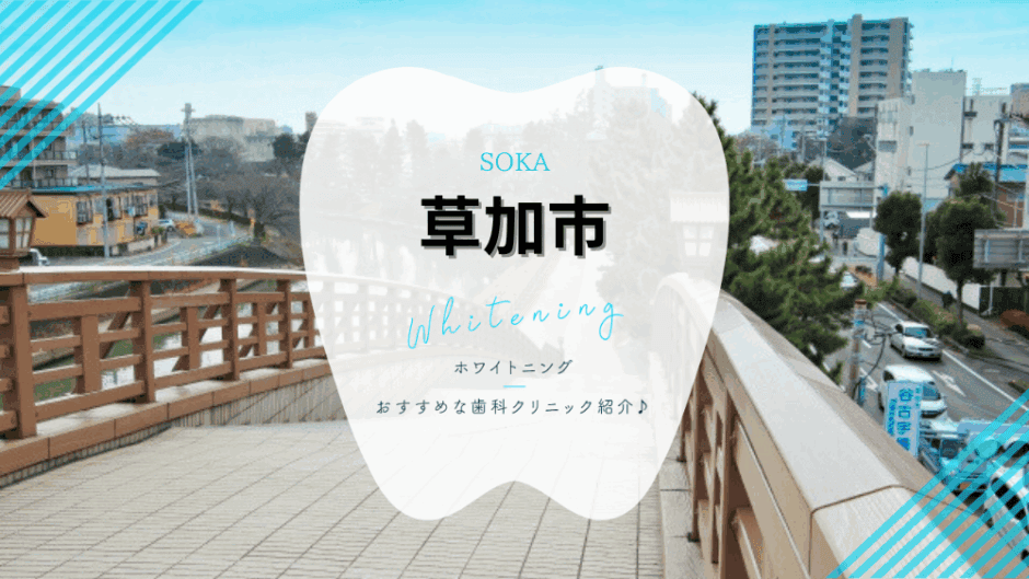 草加でホワイトニング