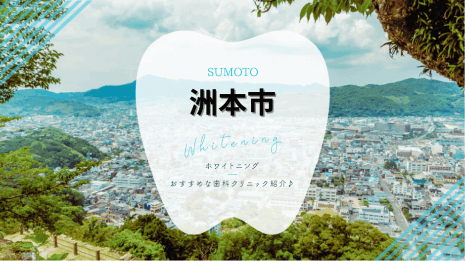 洲本でホワイトニング