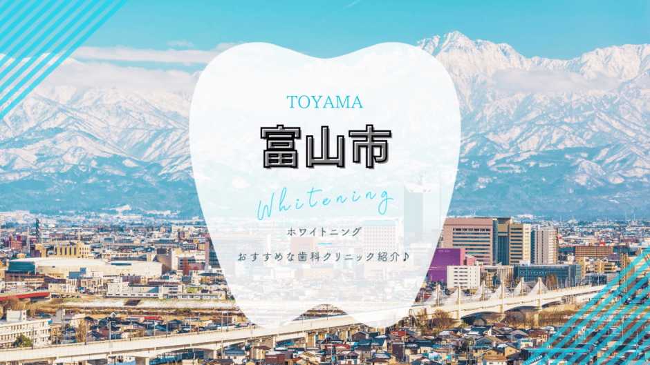 富山市でホワイトニング