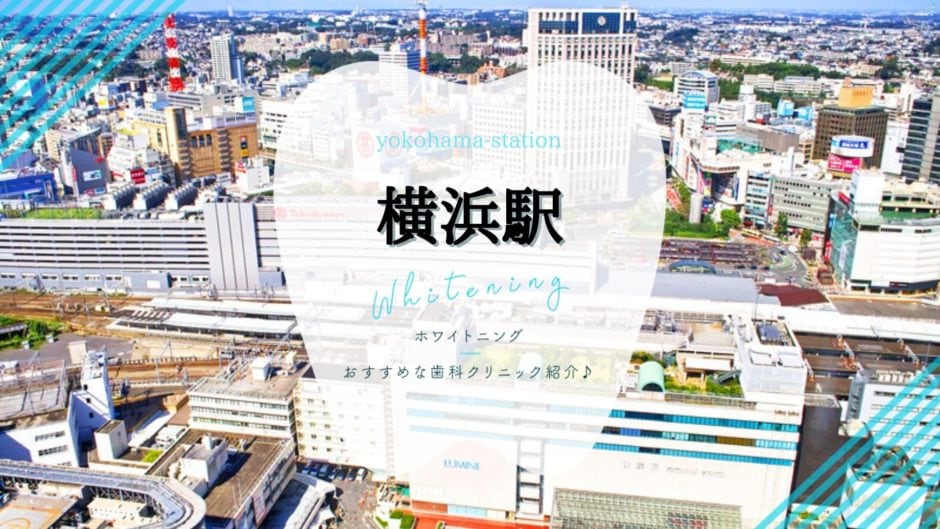 横浜駅でホワイトニング